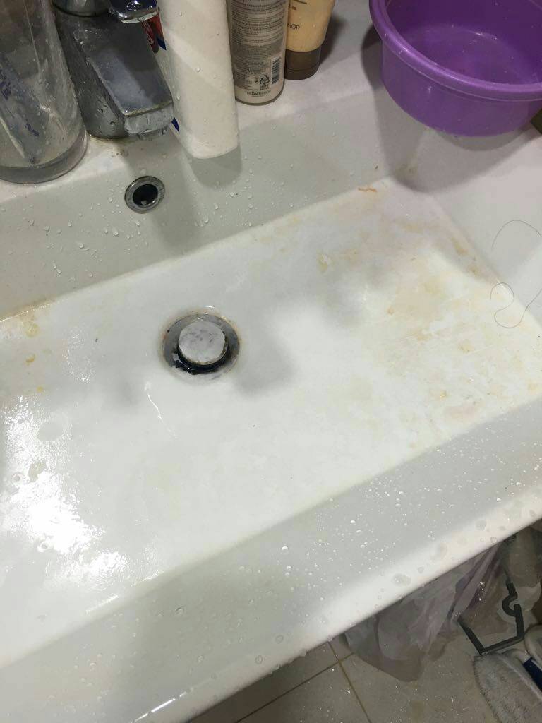 bathroom-sink-stains