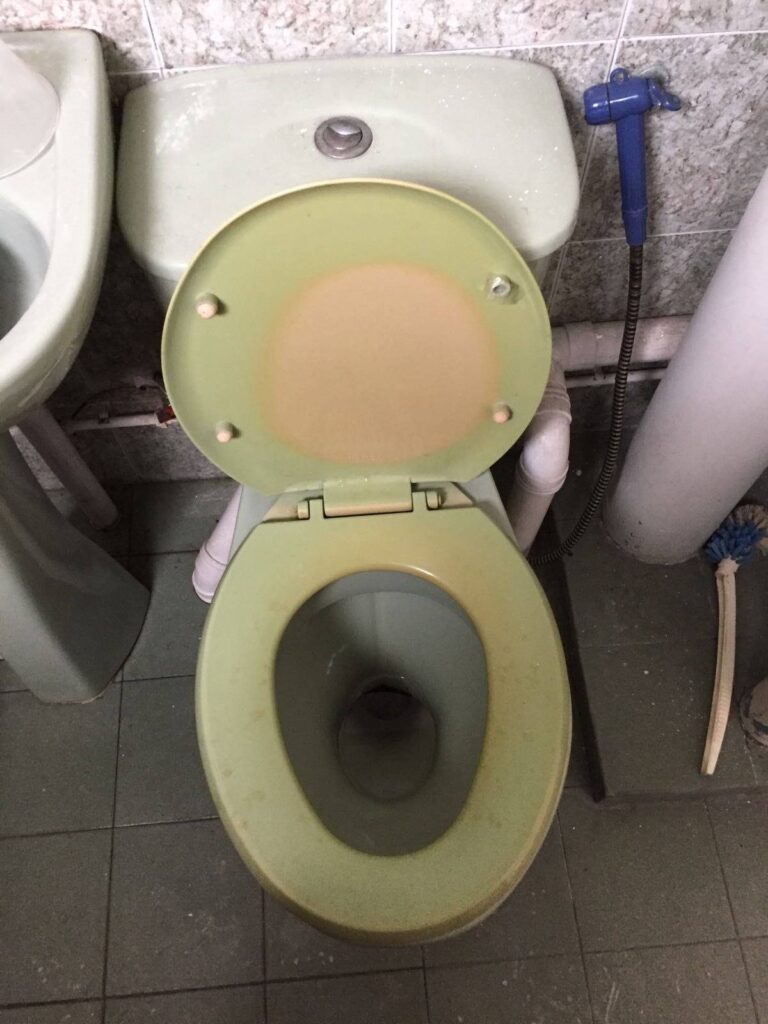 toilet seat and cover discoloured