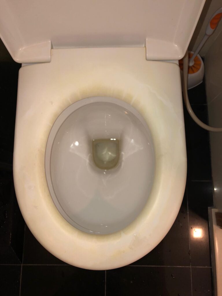 toilet seat dirty