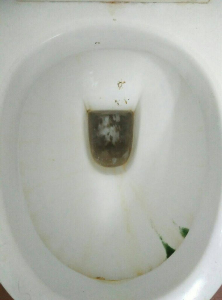 gross-toilet-bowl