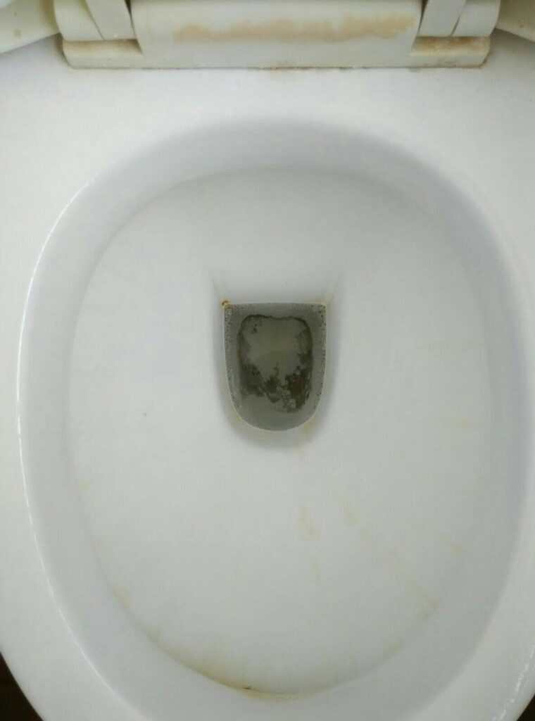 toilet-bowl-stains2
