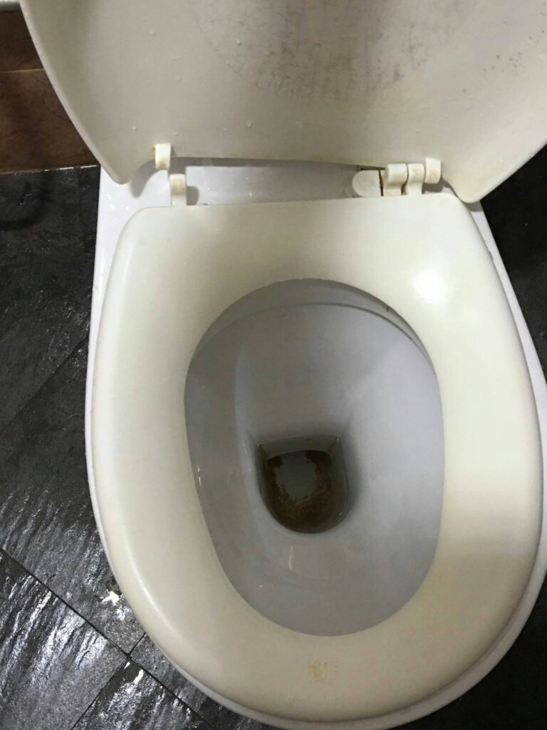 toilet-bowl-stains4
